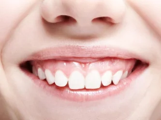 Fix Your Gummy Smile: Proven Treatments From Cosmetic to Surgical Solutions