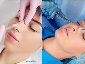 Rinofiller o rinoplastia en Turquía: lo que debes saber antes de decidir