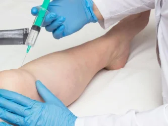 PRP et arthrose : régénérer le cartilage sans chirurgie