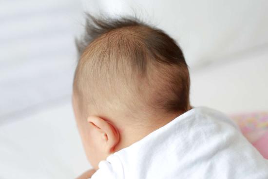 Craniosynostosis treatment