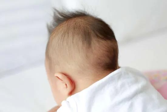 Craniosynostosis treatment