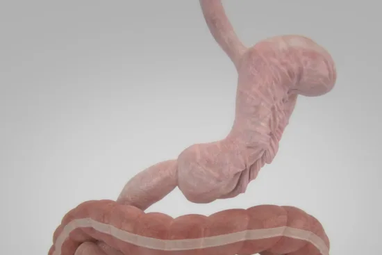 Endoscopic gastric plication