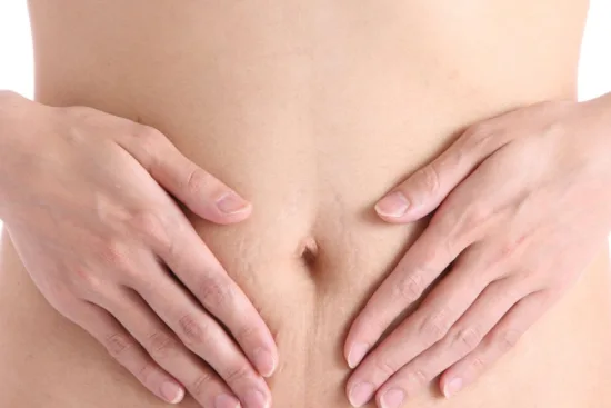 Tratamiento de la diástasis abdominal Tratamiento de la diástasis abdominal