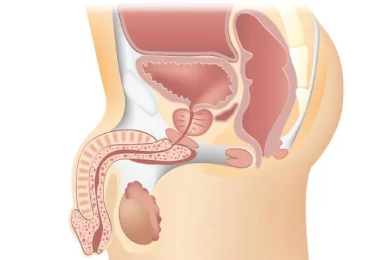 Prostate surgery