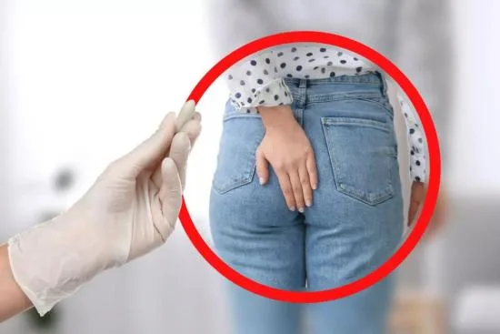 Treatment of anal fissures