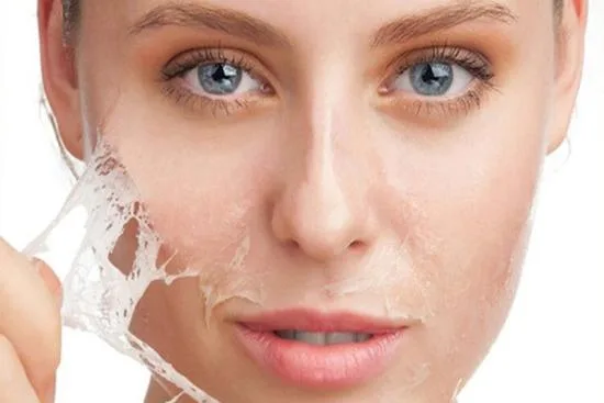 Chemical peeling Chemical peeling
