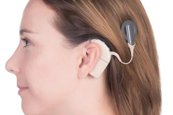 Cochlear implant