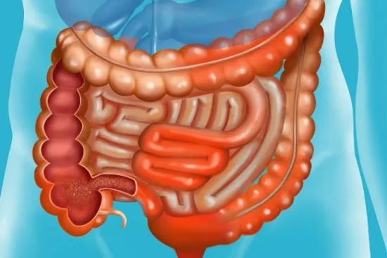 Treatment of Crohn's disease