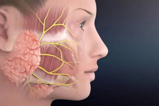Removal of salivary gland tumor
