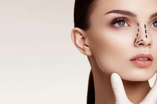 Rhinoplasty Rhinoplasty