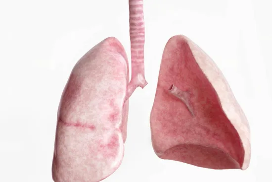 Pneumonectomie