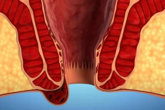 Anal sphincter repair