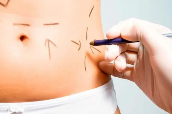 Tummy tuck cost in Turkey Tummy tuck cost in Turkey