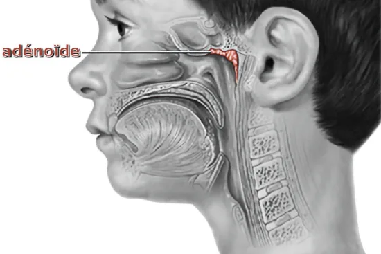 Etiological factors in adenoid hypertrophy 2026 Etiological factors in adenoid hypertrophy 2026
