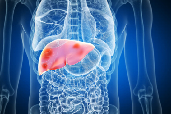 Tratamiento del cáncer de hígado
