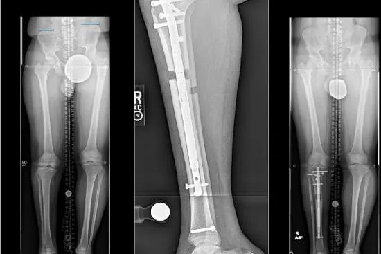 Postoperative phase 2026 Postoperative phase 2026
