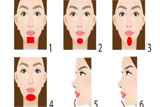 What is chin augmentation surgery and who is it for? 2026 What is chin augmentation surgery and who is it for? 2026