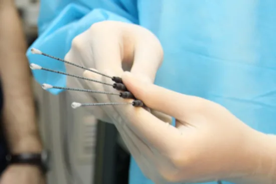 Endometrial biopsy procedure Endometrial biopsy procedure