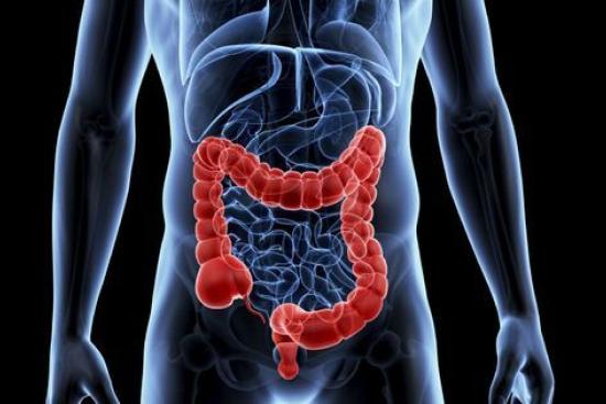 Colorectal cancer treatment Turkey