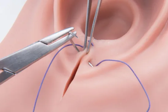 Laser hemorrhoid removal surgery in Turkey 2026 Laser hemorrhoid removal surgery in Turkey 2026