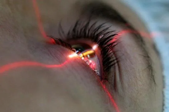LASIK eye surgery in Turkey LASIK eye surgery in Turkey