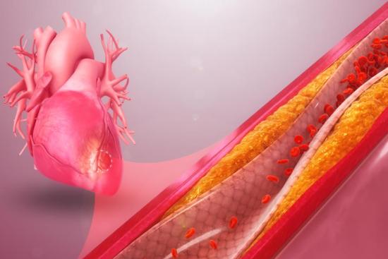 Coronary disease treatment Turkey