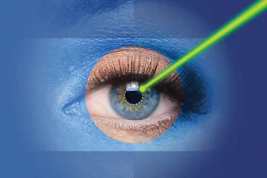 Astigmatism correction Astigmatism correction