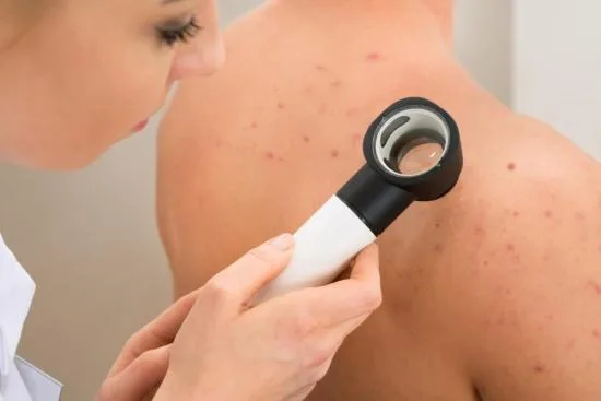 Les maladies cutanées Les maladies cutanées