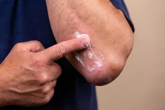 Dermatologues à Istanbul Dermatologues à Istanbul