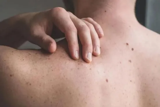 Dermatologie Dermatologie