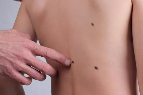 Dermatologie Turquie Dermatologie Turquie