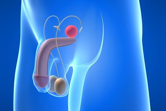 Penile prosthesis