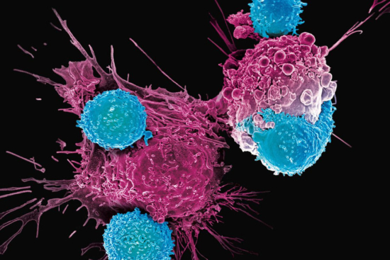 CAR-T Therapy