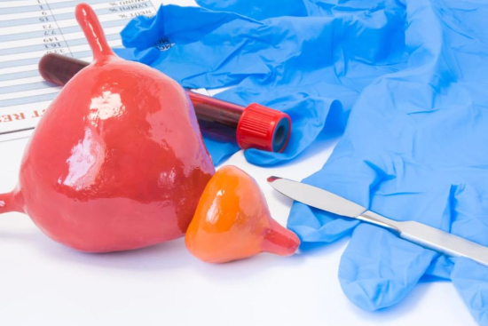 Prostatectomy