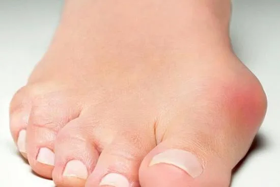 عملية تجميل إصبع الإبهام عملية تجميل إصبع الإبهام