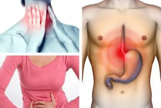 Tratamiento de la enfermedad por reflujo gastroesofágico