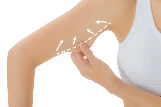 Brachioplasty in Turkey Brachioplasty in Turkey