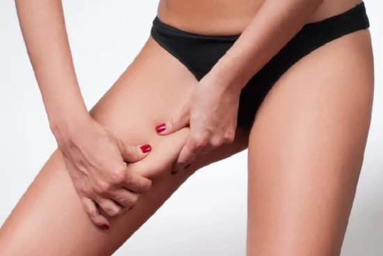 What types of thigh lift are available in Istanbul? 2026 What types of thigh lift are available in Istanbul? 2026