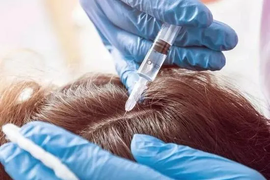 Hair Stem cell treatment in Turkey 2026 Hair Stem cell treatment in Turkey 2026