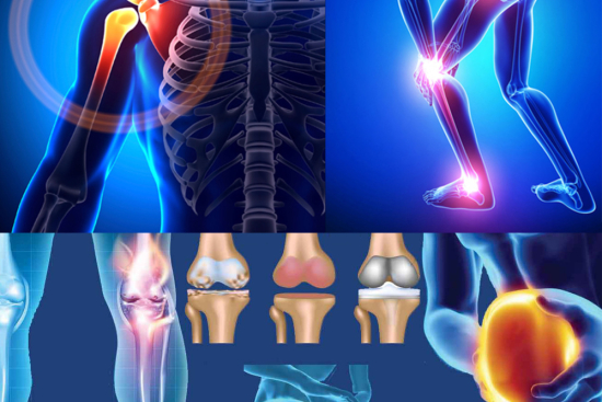 Orthopedics Turkey