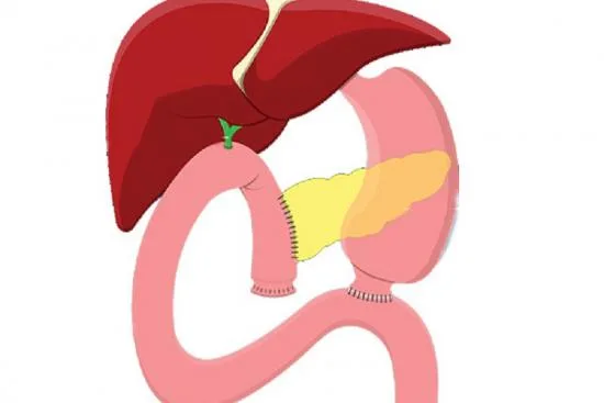 Pancreatic cancer: What to do? 2026 Pancreatic cancer: What to do? 2026