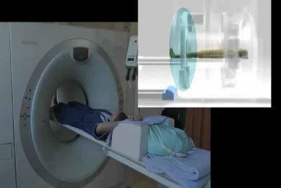 What is a PET-Scan or PET-CT? 2026 What is a PET-Scan or PET-CT? 2026