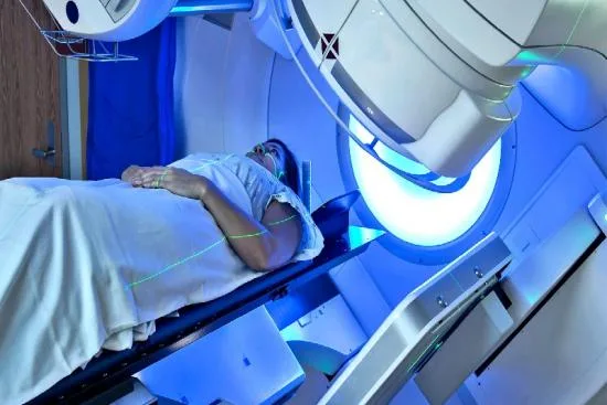 Side effects of radiation 2026 Side effects of radiation 2026