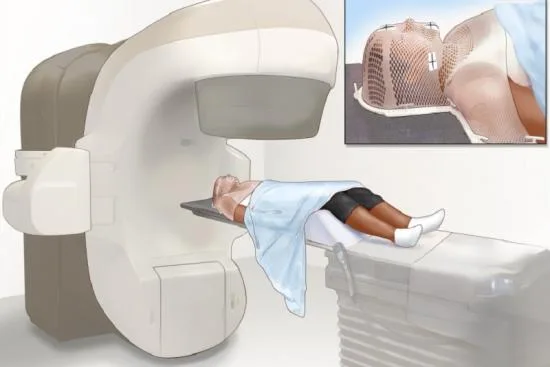 Preparing for radiotherapy: steps to follow 2026 Preparing for radiotherapy: steps to follow 2026