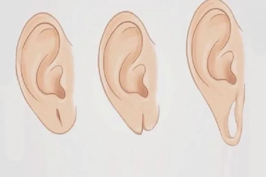 Earlobe closing in Turkey 2026 Earlobe closing in Turkey 2026