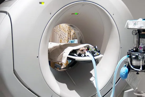 Computed tomography (CT-Scan)