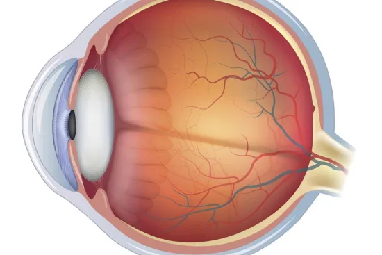 eye floaters treatment in Turkey eye floaters treatment in Turkey