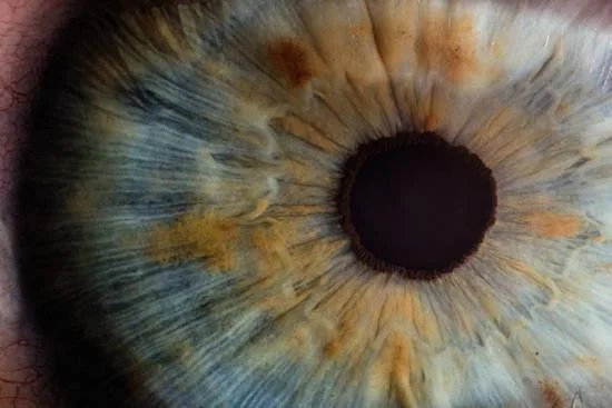 What is glaucoma? 2026 What is glaucoma? 2026