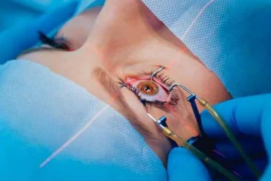 Keratoconus surgery price in Turkey Keratoconus surgery price in Turkey