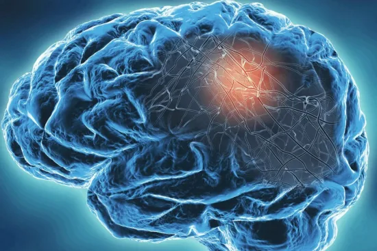 Comprender la epilepsia 2026 Comprender la epilepsia 2026